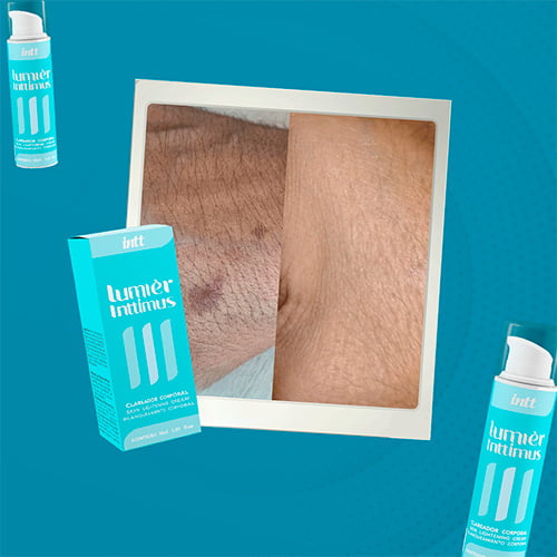 Clareador Íntimo Lumièr Inttimus resultado antes e depois rosto manchas