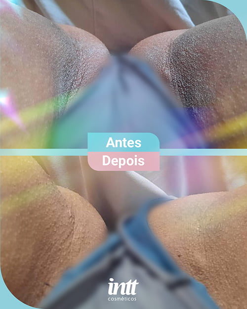 Clareador Íntimo Lumièr Inttimus resultado antes e depois virilha